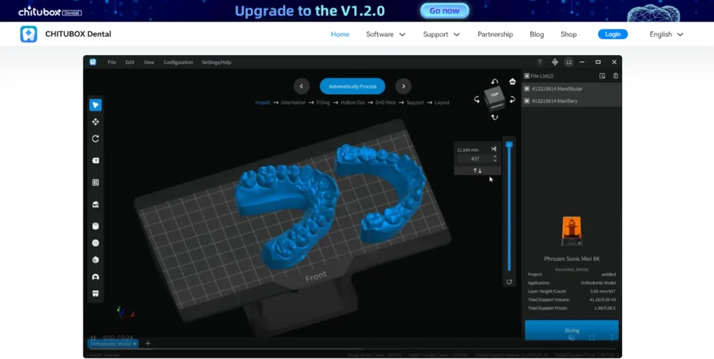 What Can 3D Printing Help Dental Exploring the Benefits of CHITUBOX Dental