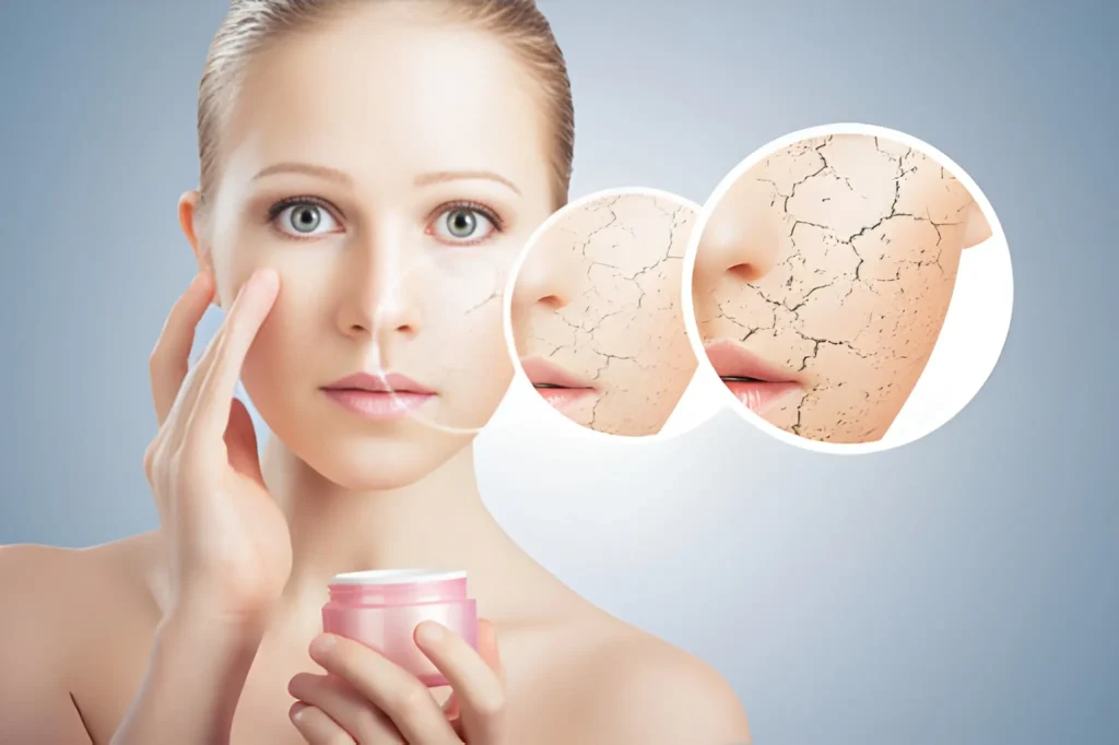 How to Choose the Right Skin Products for Dry Skin That Truly Hydrate