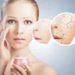 How to Choose the Right Skin Products for Dry Skin That Truly Hydrate